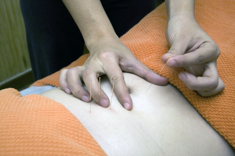 osteopathe-ANTIBES-min_acupuncture-4175625